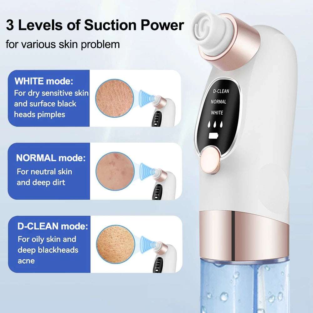 Blackhead Remover Vacuum – Deep Pore Face Cleaner