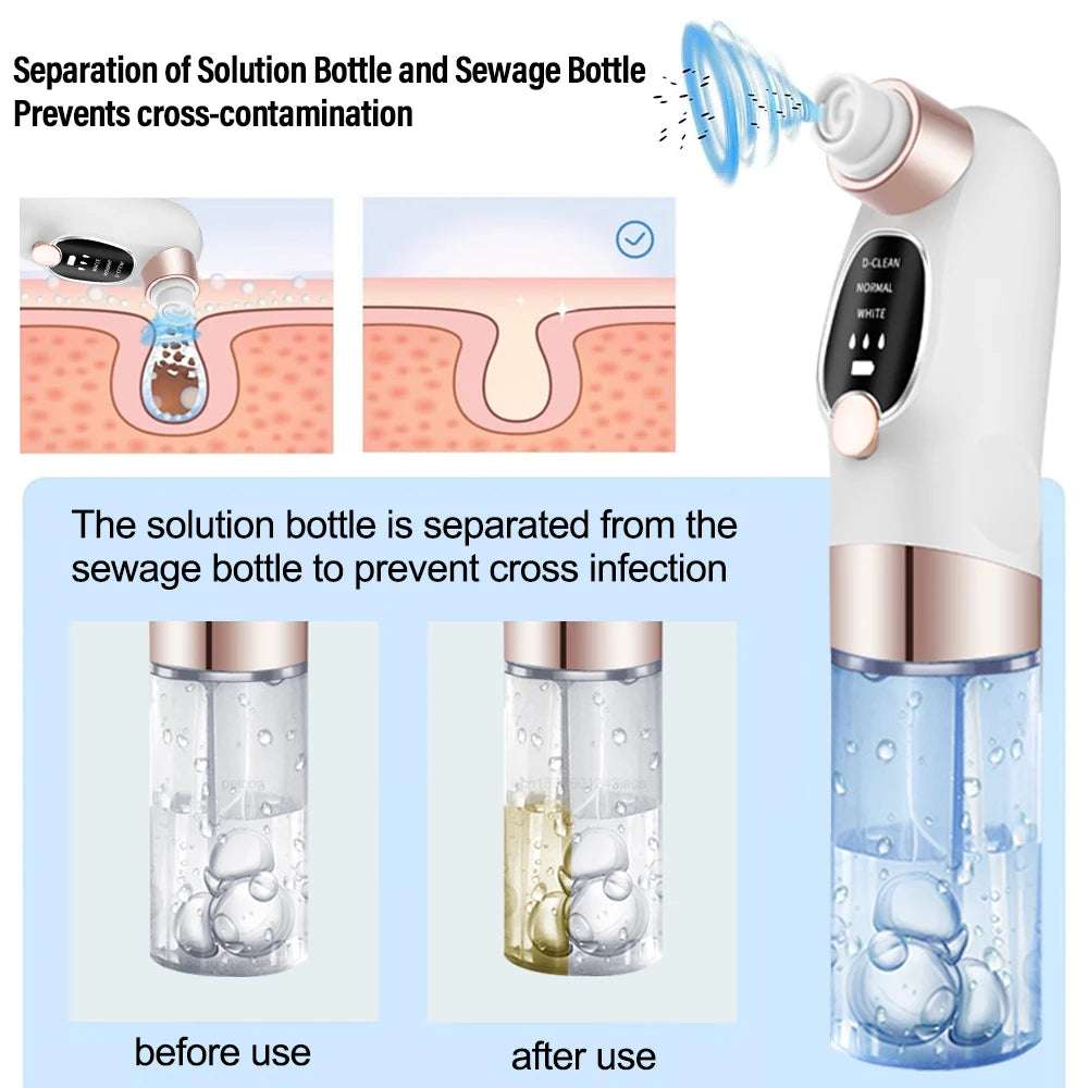 Blackhead Remover Vacuum – Deep Pore Face Cleaner