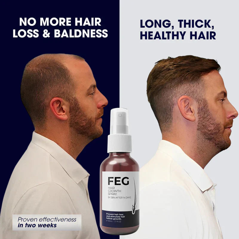 FEG Plus Hair Growth spry