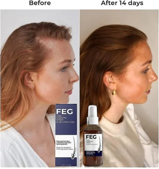FEG Plus Hair Growth spry
