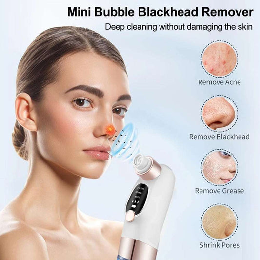 Blackhead Remover Vacuum – Deep Pore Face Cleaner