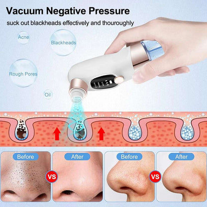 Blackhead Remover Vacuum – Deep Pore Face Cleaner