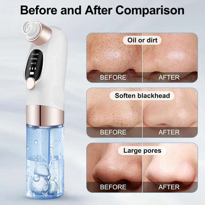 Blackhead Remover Vacuum – Deep Pore Face Cleaner