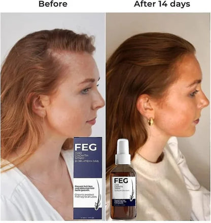 FEG Plus Hair Growth spry